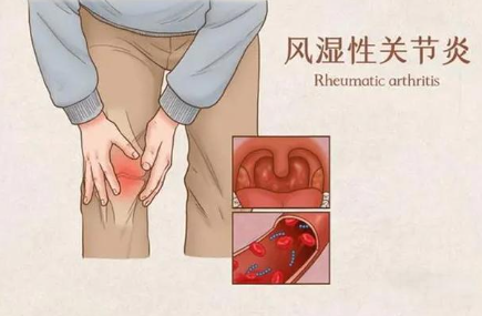邵陽創(chuàng)傷骨科,邵陽風濕病區(qū),邵陽骨質(zhì)增生,邵陽關節(jié)病區(qū),邵陽頸椎病區(qū)