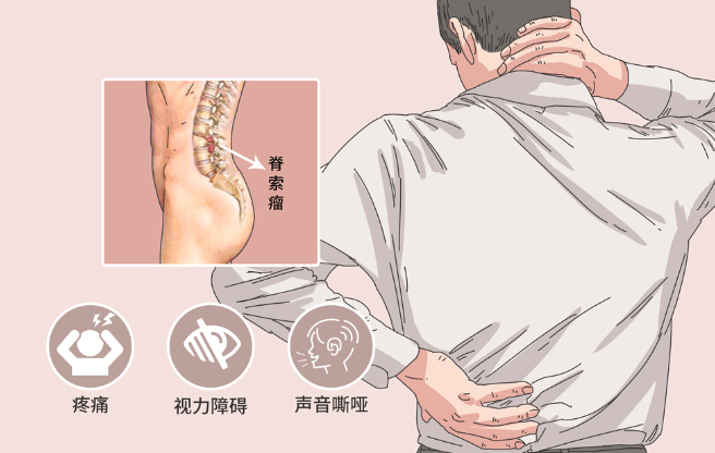 邵陽創(chuàng)傷骨科,邵陽風濕病區(qū),邵陽骨質(zhì)增生,邵陽關(guān)節(jié)病區(qū),邵陽頸椎病區(qū)