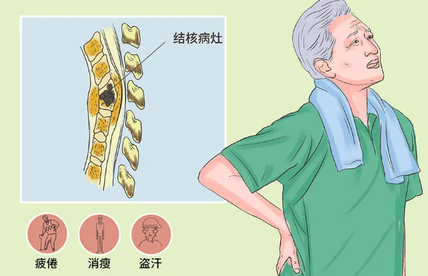 邵陽創(chuàng)傷骨科,邵陽風濕病區(qū),邵陽骨質增生,邵陽關節(jié)病區(qū),邵陽頸椎病區(qū)